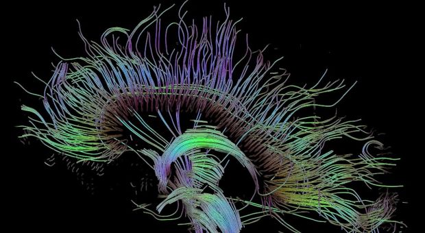 Eine MRT-Aufnahme von Nervenbahnen im Gehirn. (c) Thomas Schultz/Wikimedia Commons